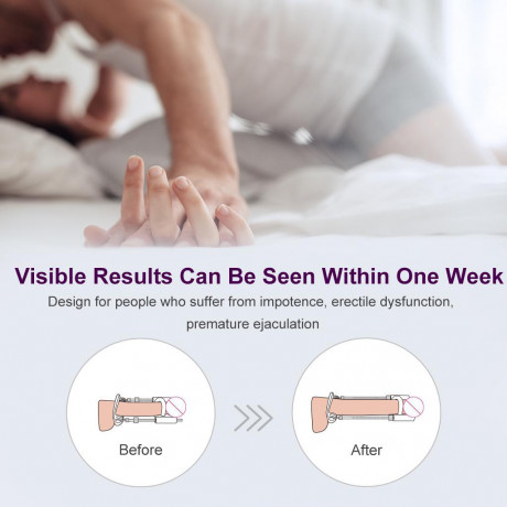 "Penis Extender" для увеличения члена